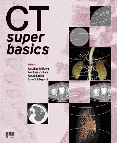CT super basics
