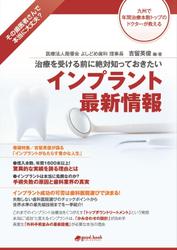 治療を受ける前に絶対知っておきたい　インプラント最新情報